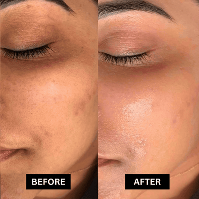 Moisturizing Collagen Patches